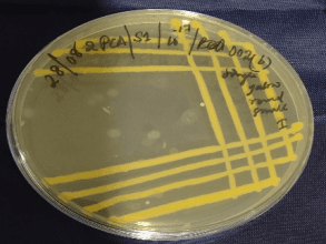 Bharalu Project: Exploring Microbial Diversity of the Bharalu River - 2