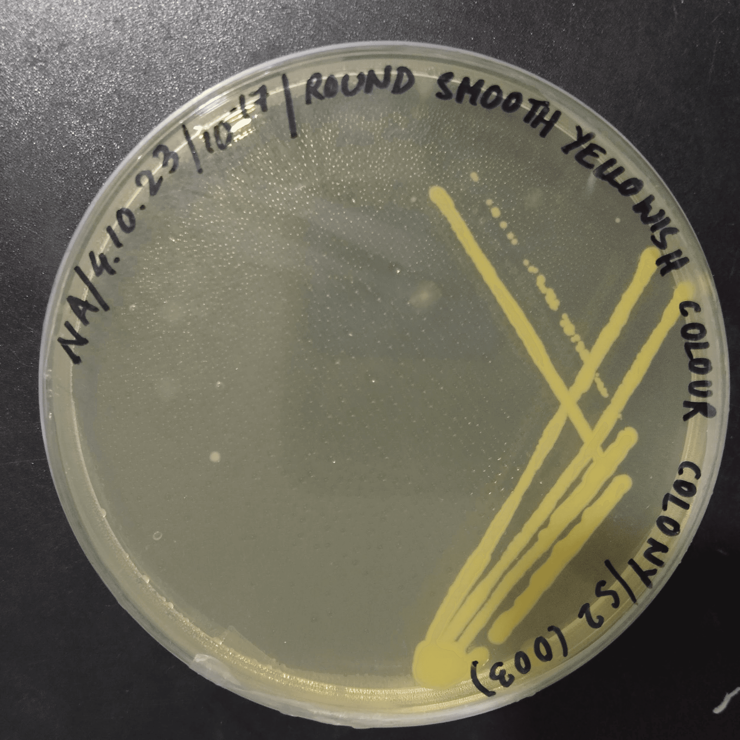 Bharalu Project: Exploring Microbial Diversity of the Bharalu River - 3